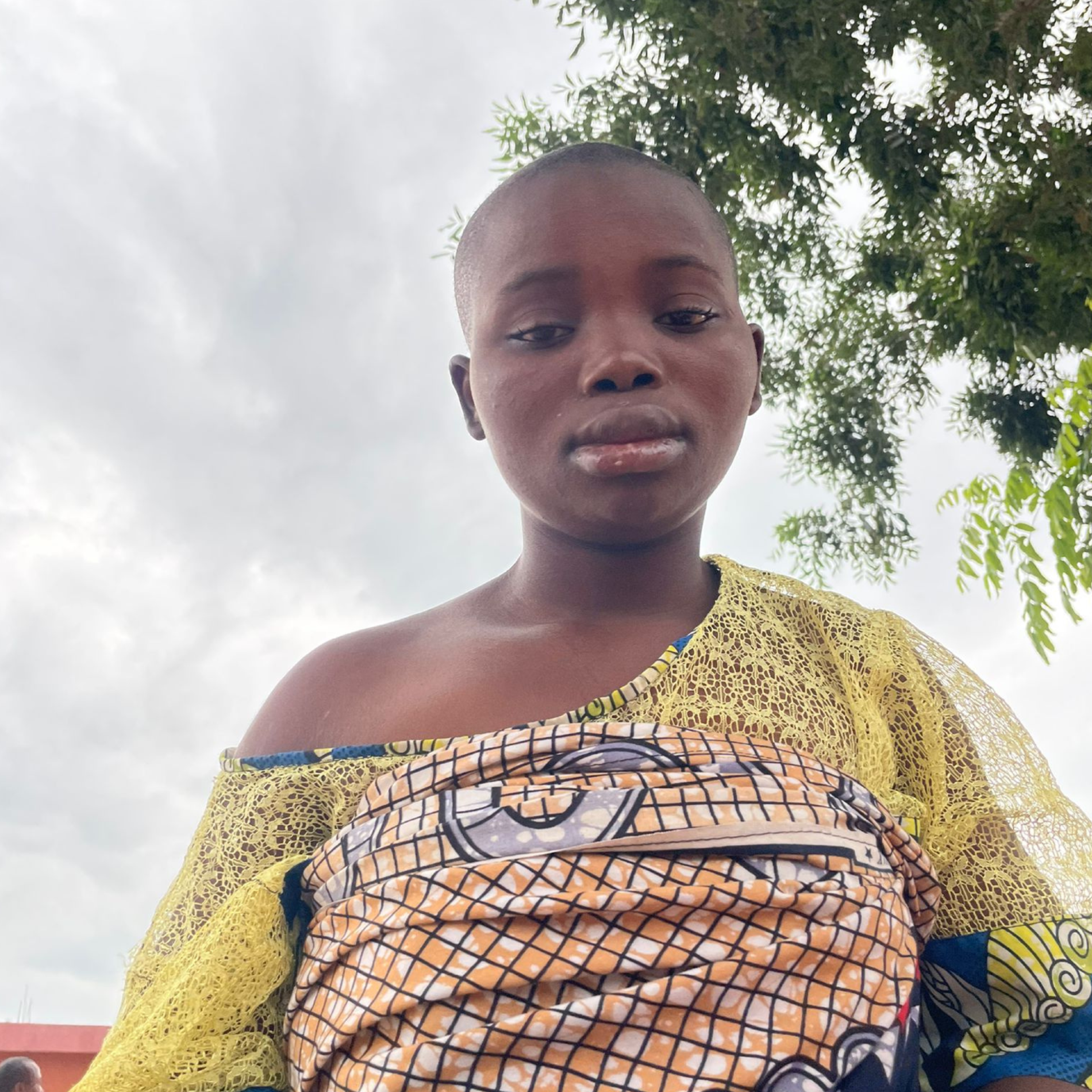 BENIN